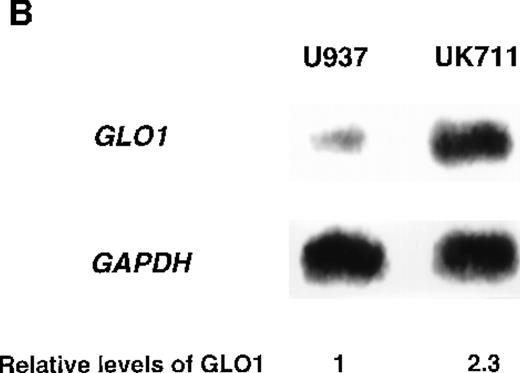 Fig. 1. Overexpression of GLO1 in apoptosis-resistant UK711 cells. / (A) Wild-type U937 (W) and the mutant UK711 (M) cells were incubated with 5 μmol/L of VP-16 for 6 hours or 0.6 μmol/L of ADM for 12 hours. After the harvest of the cells, nuclear DNA fragmentation was analyzed by 2% agarose gel electrophoresis. (B) Northern blot analysis was carried out with mRNAs prepared from U937 and UK711 cells. The RNAs were transferred to nylon membranes and probed with the GLO1gene fragment (upper panels). Blots were also rehybridized with a GAPDH probe as a control (lower panels). Expression of the mRNA was quantified by densitometric analysis.