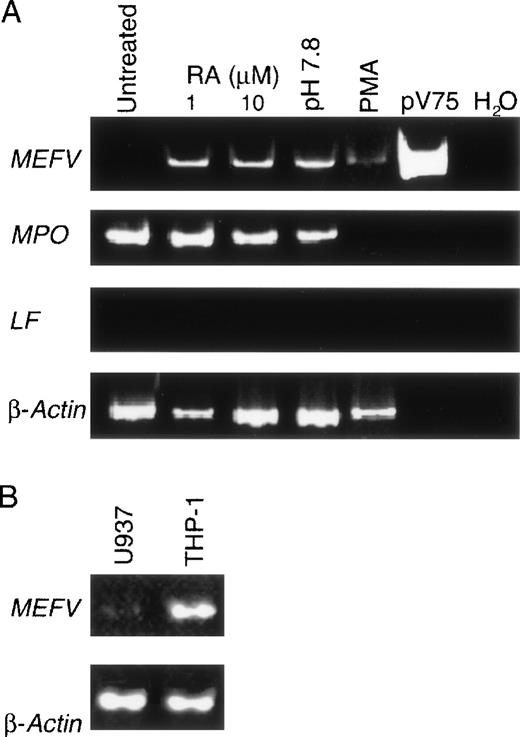Fig. 3. MEFV expression in unstimulated and in vitro differentiated myelomonocytic cell lines. / (A) EtBr-stained PAGE of RT-PCR products of the MEFV, LF, MPO, and β-actin RNAs from resting untreated HL60 cells (lane 1) and cultured HL60 cells induced to differentiate toward the neutrophilic lineage with 1 or 10 μmol/L retinoic acid (lanes 2 and 3), toward the eosinophilic lineage with alkaline pH (pH 7.8; lane 4), and toward the monocytic lineage with phorbol ester. Positive and negative control PCR reactions using the MEFV-containing plasmid pV75-1 and water, respectively, are shown. (B) EtBr-stained PAGE of RT-PCR products of the MEFV and β-actin mRNAs from the monocytic cell lines U937 and THP-1.