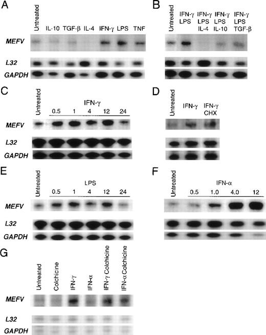 Fig. 5. Quantitation of cytokine- and lipopolysaccharide (LPS)-mediated regulation of MEFV mRNA levels in peripheral blood myelomonocytic cells. / Autoradiograms of results obtained with RNase protection assay of total RNA derived from peripheral blood leukocytes by using an MEFVgene-specific riboprobe and 2 housekeeping gene–specific riboprobes (L32 and GAPDH) are shown. Baseline levels ofMEFV mRNA in resting cells before stimulation (untreated) are shown in each panel. (A) Products from monocytes treated for 24 hours in vitro with interleukin (IL) 10, transforming growth factor β (TGF-β), IL-4, interferon (IFN) γ, LPS, or tumor necrosis factor. (B) Products from monocytes treated with LPS and IFN-γ alone and with LPS and IFN-γ in combination with either IL-4, IL-10, or TGF-β. (C) Time course of MEFV induction in monocytes treated with IFN-γ for 0.5, 1, 4, 12, and 24 hours. (D) Products from untreated monocytes and monocytes treated with IFN-γ and both IFN-γ and cycloheximide. (E) Time course of MEFV induction in monocytes treated with LPS for 0.5, 1, 4, 12, and 24 hours. (F) Time course of MEFVinduction in monocytes treated with IFN-α for 0.5, 1, 4, and 12 hours. (G) Products from granulocytes treated with colchicine, IFN-γ, IFN-α, IFN-γ and colchicine, and IFN-α and colchicine.