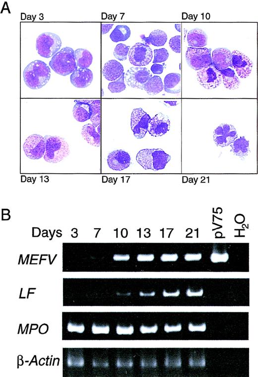 Fig. 2. Induction of MEFV expression during granulopoiesis ex vivo. / (A) Wright-Giemsa–stained cytospin preparations of cells from PBHP cultures induced to differentiate toward the granulocytic lineage. Representative images from cultures at 3, 7, 10, 13, 17, and 21 days are shown. Original magnification ×600. (B) EtBr-stained PAGE of RT-PCR products of the MEFV, lactoferrin (LF), myeloperoxidase (MPO), and β-actin mRNAs from PBHP cells collected on the days indicated. Positive and negative control PCR reactions using the MEFV-containing plasmid pV75-1 and water, respectively, are shown.