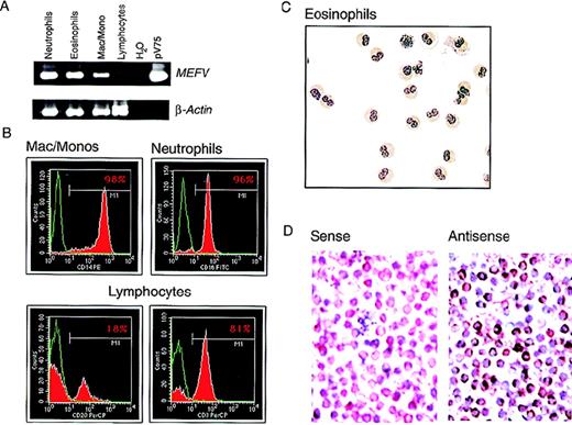 Fig. 4. MEFV expression in peripheral blood leukocytes. / (A) EtBr-stained PAGE of RT-PCR products of the MEFV and β-actin mRNAs from highly purified populations of peripheral blood neutrophils (lane 1), eosinophils (lane 2), macrophages and monocytes (lane 3), and lymphocytes (lane 4). Negative and positive control PCR reactions using water and the MEFV-containing plasmid pV75-1, respectively, are shown (lanes 5 and 6). (B) Purity of populations analyzed in A, as determined by fluorescence-activated cell sorting. Cells were stained for a cell-type–specific marker (red) and nonspecific isotype control antibody (green). The antibodies used were monocytes (anti-CD14), neutrophils (anti-CD16), B cells (anti-CD20), and T cells (anti-CD3). (C) Wright-Giemsa–stained cytospin preparations of eosinophils used for these analysis. Original magnification ×400. (D) Photomicrographs of Wright-Giemsa–stained monocyte in situ hybridizations. Results with use of a gene-specificMEFV antisense riboprobe (right panel) and a nonspecificMEFV sense strand control riboprobe (left panel) are shown. Original magnification ×400.
