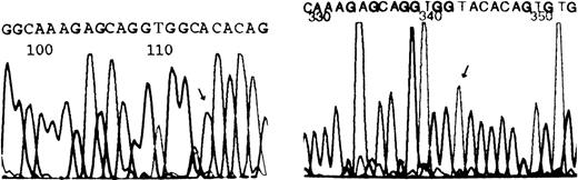 Fig. 3. Nucleotide sequence analysis of the b5R gene from the propositus. / The sequence shown corresponds to the nonencoding strand of the gene of a normal individual (left) or the propositus (right). The arrow indicates a homozygous G→A transition at the second position of codon 203. This mutation results in a replacement of cysteine by tyrosine.