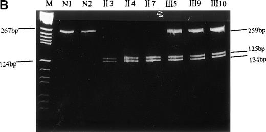 Fig. 4. Identification of the missense mutation in exon 7 of the b5R gene by PCR/restriction analysis. / (A) Diagram of genomic restriction enzyme analysis. The 262-bp genomic fragment of exon 7 was amplified. The mutated allele possesses an additional RsaI site and produces 3 fragments (3 bp, 125 bp, 134 bp) upon digestion. (B) Restriction enzyme analysis. The 262-bp genomic PCR fragments from the propositus, some of her family members, and a normal control were digested with RsaI and electrophoresed on 12% polyacrylamide gel. The 2 visible products of digestion are indicated by arrows. The DNA markers used areBsuRI digests of pBR322 (MBI). N1 and N2 indicate the PCR products of the normal control after and before digestion, respectively.