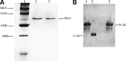 Fig. 6. Gel electrophoresis and Western blotting of GST-fused b5R and GST-fused Cys203Tyr b5R. / (A) Gel electrophoresis of GST-fused b5Rs expressed in E. coliBL21. A total of 5 μg of GST-fused b5R or GST-fused Cys203Tyr b5R purified with glutathione Sepharose 4B was subjected to electrophoresis on 10% SDS-polyacrylamide gel. Lane 1, molecular weight markers used are phosphorylase B (94 kd), bovine serum albumin (67 kd), actin (43 kd), and bovine carbonic anhydrase (31 kd). Lane 2, GST-fused Cys203Tyr b5R. Lane 3, GST-fused wild-type b5R. (B) Western blotting of GST-fused b5R and GST-fused Cys203Tyr b5R purified with glutathione Sepharose 4B. Lane 1, GST-fused wild-type b5R. Lane 2, known rb5R as control (see text). Lane 3, GST-fused Cys203Tyr b5R.