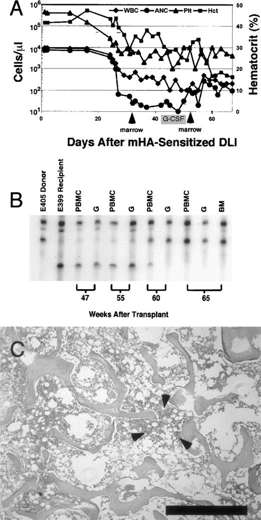 Fig. 4. Summary of hematologic data from dog E399, which developed marrow aplasia after mHA-sensitized DLI. / (A) Peripheral blood counts recorded from the time of mHA-sensitized DLI. Total white blood cell count (μL), absolute neutrophil count (μL), and platelet count (μL) are plotted on the left y axis (log scale). Hematocrit is plotted on the right y axis. Arrows indicate infusion of donor marrow in an attempt to restore hematopoiesis. There was no marked recovery of absolute neutrophil count after marrow infusions. Recombinant granulocyte colony-stimulating factor was administered for the period shown. Dog E399 was humanely killed because of pneumonia 67 days after mHA-sensitized DLI. (B) Representative microsatellite marker studies at selected times. Dog E399 received 4.5-Gy lymph node irradiation, DLA-identical littermate marrow, and postgrafting therapy with mycophenolate mofetil and cyclosporine for 4 weeks and 5 weeks, respectively. Low-level donor chimerism (4%-5%) was unchanged after DLI given 25 weeks after grafting (data not shown). Skin-graft–sensitized mHA-sensitized DLI was given in week 56. After the onset of pancytopenia in week 59, complete donor chimerism was observed in PBMC, granulocyte, and bone marrow fractions. (C) Photomicrograph of biopsy specimen obtained at necropsy from anterior rib marrow of dog E399 showing hypocellular (5%) marrow. Also shown is a rare focus of primarily lymphoid hematopoiesis observed in 2 of 10 fields (arrows). The remaining marrow space contains predominantly red blood cells and few fibroblasts. Biopsy specimens (not shown) from the posterior iliac crest showed complete absence of hematopoiesis. Bar indicates 1 mm. (Stain, hematoxylin & eosin; magnification × 25.)