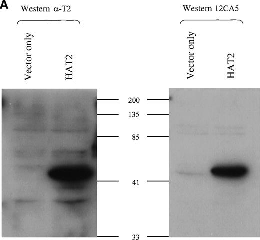 Fig. 4. TEL2-specific antibodies. / (A) Western blot analysis of TEL2-specific antibodies (α-T2). Western blots containing proteins from the indicated Hela-cell lysates were made and incubated with either anti-TEL2 antisera (α-T2) (left) or an anti-HA antibody (12CA5) (right). MW standards are indicated in kilodaltons (kd). (B) Immunoprecipitation of TEL2 with α-T2. Indicated lysates isolated from Hela cells were incubated with α-T2. IP products were separated by SDS-PAGE, Western blotted, and probed with the 12CA5 aby. MW standards are shown on the right.