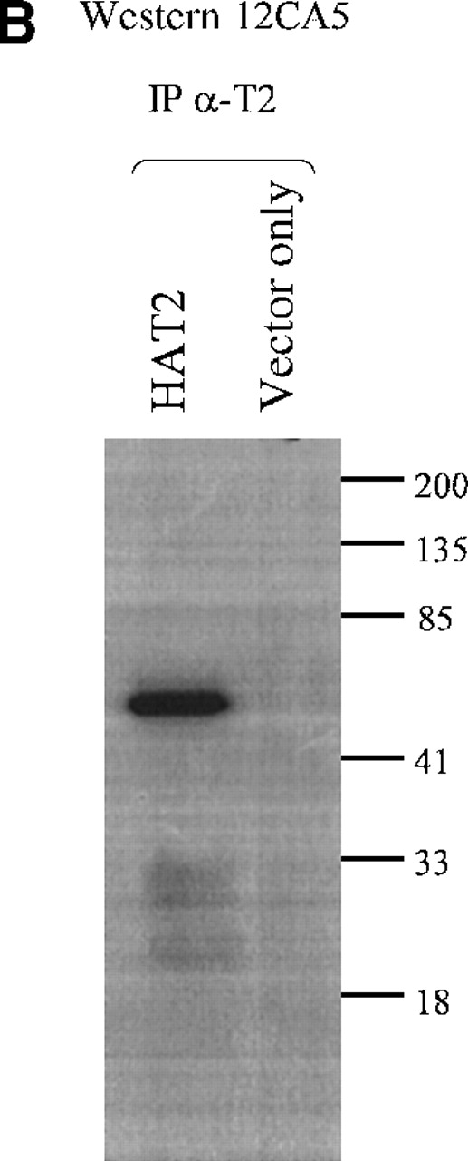 Fig. 4. TEL2-specific antibodies. / (A) Western blot analysis of TEL2-specific antibodies (α-T2). Western blots containing proteins from the indicated Hela-cell lysates were made and incubated with either anti-TEL2 antisera (α-T2) (left) or an anti-HA antibody (12CA5) (right). MW standards are indicated in kilodaltons (kd). (B) Immunoprecipitation of TEL2 with α-T2. Indicated lysates isolated from Hela cells were incubated with α-T2. IP products were separated by SDS-PAGE, Western blotted, and probed with the 12CA5 aby. MW standards are shown on the right.