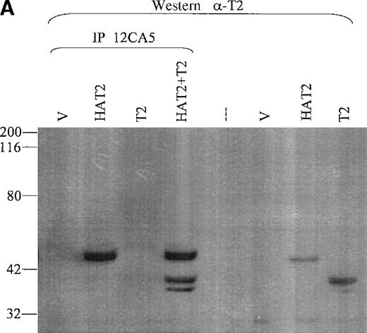 Fig. 7. Coimmunoprecipitation of TEL2. / (A) Coimmunoprecipitation of TEL2 with HATEL2. Human fibroblast cells (293T) were transiently transfected with empty vector, HAT2, T2, or HAT2 + T2, and lysates were immunoprecipitated with 12CA5. Immunocomplexes were separated by SDS-PAGE, Western blotted, and incubated with α-T2. Lysates from cells transfected with the indicated constructs were also Western blotted with α-T2 (right 3 lanes). MW standards are indicated on the left. (B) Coimmunoprecipitation of TEL2 and TEL1. Lysates of Hela cells transiently transfected with the indicated expression constructs were incubated with either α-T2 (left 3 lanes) or α-T1 antibodies (right 3 lanes). Immunoprecipitates were separated by SDS-PAGE, Western blotted, and incubated with the 12CA5 aby. MW standards are indicated on the right. (C) 293T cells were transiently transfected with the constructs indicated above each lane and lysates were immunoprecipitated with either α-T2 or α-T1. Immunoprecipitates were separated by SDS-PAGE, Western blotted, and incubated with 12CA5. MW standards are shown on the left.