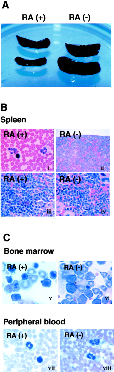 Fig. 2. Expansion of granulocyte population in RA−mice. / (A) Spleens from 17-week-old mice fed with the RA+ or RA− diet. (B) Histology of spleens from RA+and RA− mice (17 weeks old). The border between the white pulp and red pulp is discernible in the RA+ spleen (i, iii), but not in the RA− spleen (ii, iv) due to overpopulation of granulocytes. (Original magnification: i and ii, × 100; iii and iv, × 400). (C) Cytology of bone marrow cells (i, ii) and peripheral blood (iii, iv) (original magnification × 630). Myeloid cells at various stages of maturation were increased in the RA− bone marrow, relative to the RA+ samples. Panels iii and iv illustrate hypersegmented nuclei in granulocytes of RA− peripheral blood, not found in RA+ cells.