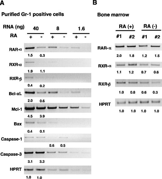 Fig. 7. RT-PCR analysis of gene expression in RA+and RA− granuloctyes. / (A) Analysis of FACS-purified granulocytes. Serially diluted RNAs from RA+ and RA− granulocytes were subjected to RT-PCR analysis for indicated genes using specific primers (see “Materials and methods”). (B) RT-PCR analysis of bone marrow samples from 16-week-old mice. The numbers indicate relative levels of transcripts.