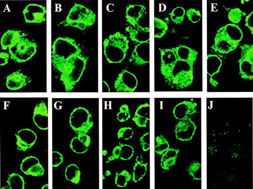 Fig. 2. Immunofluorescence of GMRβ N-glycosylation mutants in COS cells. / The COS cells grown on chamber slides were transfected with plasmids encoding wild-type or mutated GMRβ subunits and examined by immunofluorescence staining with a rabbit antihuman GMRβ subunit polyclonal antibody. (A) Wild type GMRβ; (B) GMRβ-Ala58; (C) GMRβ-Ala191; (D) GMRβ-Ala 346; (E) GMRβ-Ala58/191/346; (F) GMRβ-Asp58; (G) GMRβ-Asp191; (H) GMRβ-Asp346; (I) GMRβ-Asp58/191/346; (J) mock-transfectant.