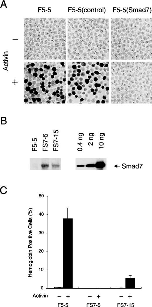 Fig. 2. Inhibitory effect of Smad7 on erythroid differentiation induced by activin. / (A) Hemoglobin accumulation in F5-5 mouse erythroid leukemia cells and in derivatives. F5-5 cells were infected with control or Smad7 transducing virus and selected for acquiring G418 resistance. After 5 days of culture with (+) or without (−) 1 nmol/L activin, cells were stained with benzidine to reveal hemoglobin content. F5-5 (control) indicates G418-resistant control cells, and F5-5 (Smad7) indicates Smad7 virus-transduced cells. (B) Immunoblotting analysis of Smad7 stably expressed in clonal cells. FS7-5 and FS7-15 cells were cloned from single G418-resistant cells that had been infected with Smad7 expression vector. The whole-cell lysate of 2 × 104 cells (left) or the indicated amount (0.4, 2, or 10 ng) of the bacterially expressed, purified Smad7 protein (amino acids 91-426; right) was loaded into each lane and subjected to electrophoresis and blotting. Smad7 was detected with specific antibody against Smad7. Densitometric analysis indicated that 2 × 104 F5-5 parent cells, FS7-5 clonal cells, and FS7-15 clonal cells contained less than 4 pg, 100 pg, and 20 pg, respectively, of Smad7 protein. (C) Effect of Smad7 level on activin-induced hemoglobin synthesis. F5-5, FS7-5, and FS7-15 cells were cultured for 5 days in the absence (−) or presence (+) of 1 nmol/L activin and assessed for hemoglobin accumulation. The results shown are the percentages of total cells that contained hemoglobin. Values are the mean and SD from 3 separate experiments.