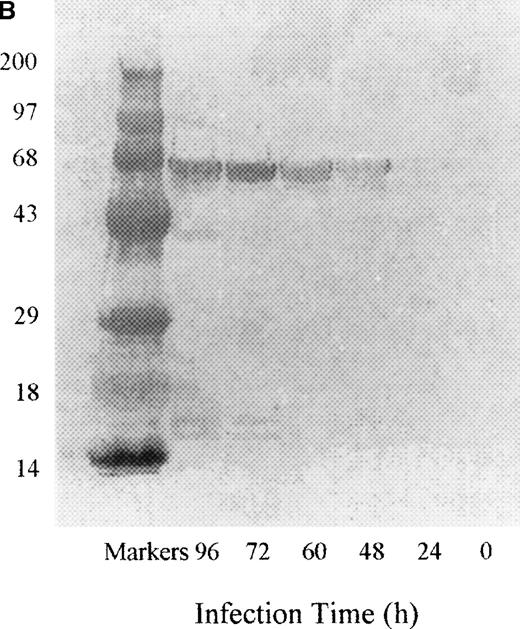 Fig. 1. Time course of expression of recombinant PDE3A in Sf9 cells. / (A) At each time point, cells were collected, counted, and lysed, and the enzymatic activity and total protein were measured as described in “Materials and methods.” The left lane contains the molecular weight standards. (B) At each time point, 10 μg protein was applied to a 10% SDS gel, transferred electrophoretically, and analyzed by Western blotting as described in “Materials and methods.”