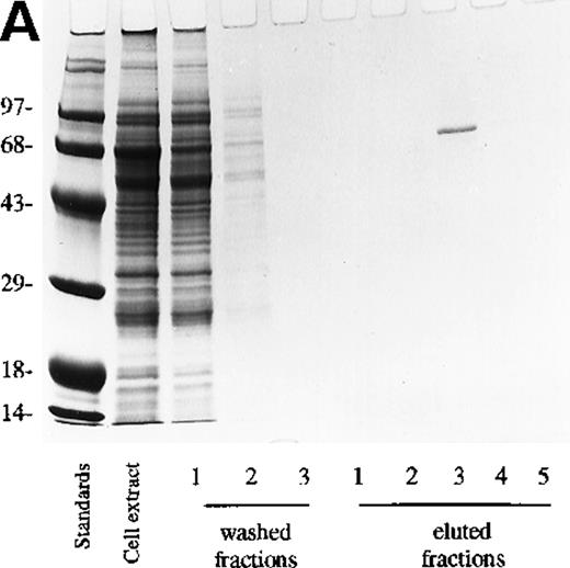 Fig. 3. Analysis of fractions from Ni-column chromatography. / Three fractions of wash buffer and 5 fractions of 250 mmol/L imidazole on 0.5 mol/L NaCl fractions of eluate were collected. (A) 10 μL were loaded onto a 10% SDS-PAGE gel and stained with Coomassie blue. (B) 10 μL was loaded on SDS-PAGE, transferred, and detected with anti-PDE3A polyclonal antibody as described in “Materials and methods.”