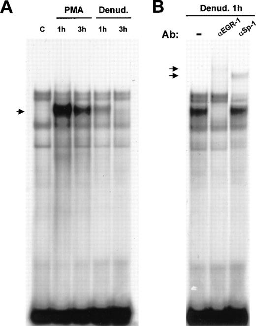 Fig. 5. Binding of Egr-1 to the −32 to −7 flt-1promoter sequence after endothelial denudation or PMA treatment. / (A) Electrophoretic mobility shift assays were performed with 3 μg nuclear extracts from HUVEC incubated with a 32P-labeled DNA probe of the (−32 to −7) flt-1 promoter region. Cell monolayers were mechanically denuded or treated with PMA (50 ng/mL) for the indicated times. C, control untreated cells. The arrow indicates the inducible complex. (B) Supershift assays were performed with polyclonal specific antibodies against Egr-1 and Sp-1 transcription factors using the same probe as in A. Ab, antibody; denud., mechanical denudation. The arrows indicate the supershifted complexes. These results are highly reproducible in more than 3 independent experiments.