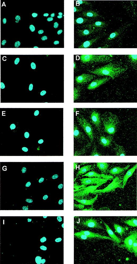 Fig. 1. Expression of Flt-1 in wounded monolayers of endothelial cells. / HUVEC monolayers were partially denuded and formaldehyde fixed at 0 (A, B), 5 (C, D), 10 (E, F), 15 (G, H), or 20 hours (I, J). (B, D, F, H, J) Cells were incubated with a rabbit-specific antibody against Flt-1 and a Cy3-conjugated goat antirabbit secondary antibody (green). Control cells (A, C, E, G, I) were incubated with the secondary antibody alone. All preparations were counterstained with DAPI to localize cell nuclei. Similar results were obtained in 2 independent experiments.