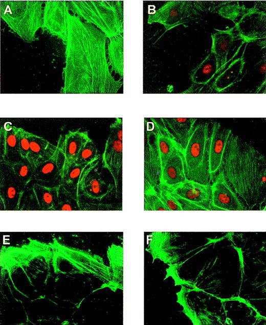 Fig. 4. Induction of Egr-1 expression in endothelial cells after mechanical denudation. / HUVEC monolayers were denuded and formaldehyde fixed after 0 (A, C, E) or 1 hour (B, D, F). (A, B) Cells were incubated with a rabbit-specific IgG against Egr-1, (C, D) with a rabbit specific IgG against Sp-1 (red), and (E, F) with the secondary antibody alone (same as Figure 1). All preparations were stained with fluorescein-conjugated phalloidin to localize the cells at the edge of the denuded area.