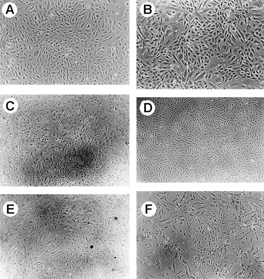 Fig. 6. Phase-contrast microscopy of human GMVECs. / Magnification × 50, except for (B) (magnification × 100). (A) Represents control GMVECs. (B) Shows the result of GMVECs incubated with PMNs for 24 hours. No change of morphology was observed. When cells were incubated with PMNs loaded with VT-1, cell death was observed after 24-hour incubation (C). (D) Represents control TNF-α–treated GMVECs. The effect of PMNs loaded with VT-1 was also studied on TNF-α–treated GMVECs (E) and compared with the effect of VT-1 on TNF-α–treated GMVECs (F). In both conditions, equal amounts of cell death were observed.