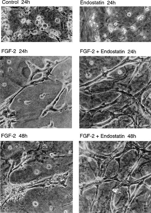 Fig. 2. Tubular morphogenesis of murine brain endothelial cells is supported by endostatin. / IBE cells were cultured between 2 layers of collagen gels, in Ham's F12, 0.25 mg/mL BSA. The cultures were incubated in the absence of additions (control) or in the presence of 1 μg/mL of endostatin and 5 ng/mL of FGF-2 alone or in combination for 24 or 48 hours. The cultures were analyzed by light microscopy and photographed (×20 objective).