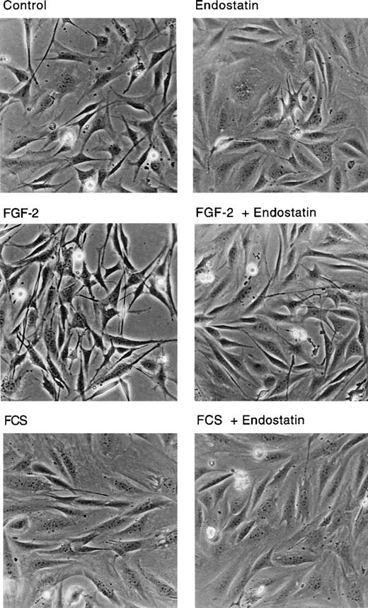 Fig. 4. Cell shape change in endostatin-treated cells. / IBE cells cultured on fibronectin-coated dishes were treated with 1 μg/mL endostatin, 5 ng/mL FGF-2, and 10% FCS in different combinations as indicated for 24 hours. The cultures were analyzed by light microscopy and photographed.