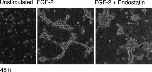 Fig. 6. Decreased tubular morphogenesis of IBE cells overexpressing Shb in response to endostatin. / IBE/Shb cells were grown in collagen as in Figure 2 for 48 hours in the absence of FGF-2, presence of 5 ng/mL FGF-2, or presence of FGF-2 and 1 μg/mL endostatin, as indicated. Scoring of the endostatin-induced decrease in tubular morphogenesis (defined as tubular structures with a diameter of 1 cell and a length of more than 7 cells) led to the estimation that endostatin diminished the number of tubular structures by 54% ± 1.9% (n = 3, P < .01) in the IBE/Shb cells.
