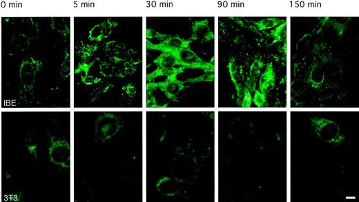 Fig. 3. Rapid internalization and degradation of endostatin. / IBE cells or Swiss 3T3 cells were incubated in the absence (control) or presence of 10 μg/mL biotinylated endostatin for different periods from 5 minutes to 150 minutes. Binding was identified using Alexa 488-labeled avidin l that was added to the control and endostatin-incubated samples, which subsequently were analyzed microscopically (Bar, 10 μM). Upper panels show IBE cells cultures; lower panels show Swiss 3T3 cell cultures.