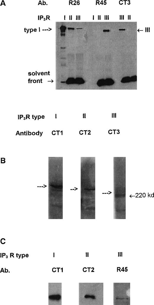 Fig. 1. Specificity of antibodies and presence of1,4,5IP3R in platelets. / (A) Approximately 18 ng immunopurified type I, mainly type II, and mainly type III 1,4,5IP3R (see “Results” and ref. 24) were run in the lanes indicated and probed with antibodies R26, R45, and CT3 using Western blotting. Arrow indicates position of IP3R. R45 and CT3 are highly specific for the type III receptor and R26 for the type I receptor. Cross- reactivity by R26 in lanes for the types II and III receptors reflects co-immunopurification of the type I receptor from AR4-2J and RINm5F cells. (B) Western blot analysis of platelet-mixed membranes with the antibodies CT1 (to type I), CT2 (to type II), and CT3 (to type III receptor). Arrows reflect position of IP3 receptors. (C) Equal amounts of platelet lysates were immunoprecipitated with equal amounts of either CT1, CT2, or R45 antibodies. Immunoprecipitates were reprobed with the respective antibodies on Western blots. Each blot is typical of 3 separate experiments.
