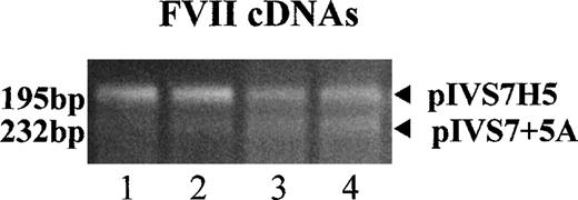 Fig. 3. mRNA expression studies with RT-PCR–amplified fragments of FVII mRNA expressed in BHK cells cotransfected with pIVS7H5 and pIVS7 + 5A (internal control). / The following pIVS7 + 5A/pIVS7H5 DNA concentration ratios were used in lanes 1-4: 1:1, 1:0.3, 1:0.15, and 1:0.1, respectively.