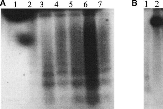 Fig. 1. GSNO and HEL cell endonucleosomal DNA cleavage. / (A) Autoradiographic analysis of total cellular DNA prepared from HEL cells after treatment with 100 μmol/L GSNO for different times and 3′-end labeled (1 μg DNA/lane). The characteristic endonucleosomal fragmentation of DNA into 185-bp multiples is visible as early as 30 minutes after treatment with 100 μmol/L GSNO. 1, Untreated HEL cells; 2, HEL cells treated with 100 μmol/L GSNO for 30 minutes; 3, for 1 hour; 4, for 2 hours; 5, for 3 hours; 6, for 4 hours; and 7, for 5 hours. (B) Autoradiographic analysis of total cellular DNA prepared from HEL cells after induction of endogenous iNOS, as described in “Materials and methods.” 1, Cytokine induction of iNOS; 2, cytokine induction of iNOS in the presence of L-NMMA.