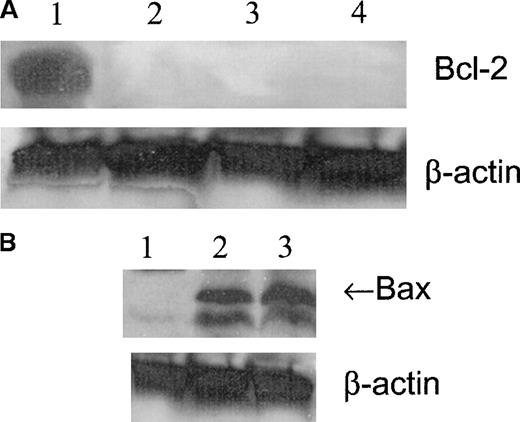 Fig. 6. Meg-01 cell Bcl-2 and Bax expression. / (A) Western blot analysis of Bcl-2 expression in Meg-01 cell lysates after treatment with 100 μmol/L GSNO for varying times. Lane 1, untreated cells; lane 2, 1 hour of treatment; lane 3, 2 hours of treatment; lane 4, 4 hours of treatment. (B) Western blot analysis of Bax expression in Meg-01 cell lysates after treatment with 100 μmol/L GSNO for varying times. Lane 1, untreated; lane 2, 1 hour of treatment; lane 3, 2 hours of treatment.