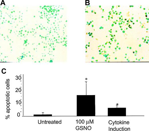 Fig. 2. GSNO or iNOS induction and Meg-01 TUNEL assay. / (A) Untreated Meg-01 cells (YOYO-1 DNA stain; 40× magnification). (B) Meg-01 cells treated with 100 μmol/L GSNO showing TUNEL-positive cells (YOYO-1 DNA stain; 40× magnification). (C) Percentage apoptotic cells visible by TUNEL assay. To calculate the percentages in each case, 5 to 10 random fields were examined, and each bar graph on the plot represents the average of these experiments (*P < .05).
