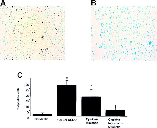 Fig. 3. GSNO induction and HEL TUNEL assay. / (A) HEL cells treated with cytokines to stimulate the expression of iNOS and TUNEL-positive cells (YOYO-1 DNA stain; 40× magnification). (B) HEL cells treated with cytokines to stimulate expression of iNOS and incubated with 100 μmol/L L-NMMA showing decreased TUNEL-positive cell staining (YOYO-1 DNA stain; 40× magnification). (C) Percentage of apoptotic cells that were visible by TUNEL assay. 5 to 10 random fields were examined to calculate the percentages in each case, and each bar in the plot represents the average of 3 experiments (*P < .05).