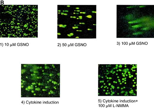 Fig. 4. HEL cell COMET assay. / (A) Depiction of different types of COMETs. (B) HEL cells treated with (1) 10 μmol/L GSNO (10× magnification); (2) 50 μmol/L GSNO (40× magnification); (3) 100 μmol/L GSNO; (4) cytokines to stimulate iNOS; and (5) cytokines in the presence of L-NMMA. YOYO-1 DNA stain was used on all parts of Figure 4.