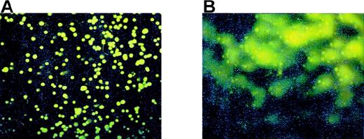Fig. 7. Peroxynitrite and Meg-01 COMET formation. / (A) Control Meg-01 cells or (B) Meg-01 cells exposed to 8 μmol/L peroxynitrite for 10 minutes.
