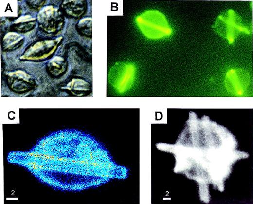 Fig. 1. In vitro crystal formation in 8A4 cells. / (A) Light microscopy of living cells (original magnification ×400). (B) Immunofluorescence on acetone/ethanol-fixed cells stained with fluorescein-labeled anti-IgG (original magnification ×400). (C and D) Confocal fluorescence microscopy of 8A4 cells: hybridoma cell stained with antimouse IgG-Cy3 conjugate. Rod-like intracellular crystals display strong signals. Intensities are coded by pseudocolors (C) or brightness (D). Scale bar: 2 μm.
