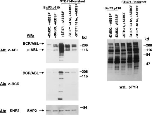 Fig. 3. BCR/ABL protein expression in STI571-resistant Ba/F3.p210 cells. / Nonresistant Ba/F3.p210 cells cultured in the presence of DMSO were treated for 20 minutes with 1 mmol/L AEBSF or water, as vehicle. STI571-resistant Ba/F3.p210 cells were cultured in the continuous presence of 1 μmol/L STI571 and then treated with 1 mmol/L AEBSF for 20 minutes. STI571-resistant Ba/F3.p210 cells were deprived of STI571 for 24 and 48 hours, respectively, and then treated with 1 mmol/L AEBSF for 20 minutes. Immunoblotting of the lysates from these cells was performed with anti-ABL (upper left-hand panel), anti-BCR (middle left-hand panel), and anti-SHP2 as a control for loading (lower left-hand panel), and anti-pTyr (upper right-hand panel).