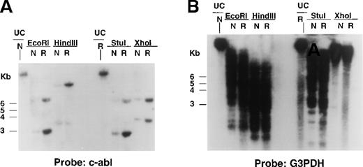 Fig. 7. Bcr/Abl gene expression in STI571-resistant Ba/F3.p210 cells. / Southern blotting was performed on EcoRI-, HindIII-, StuI-, and XhoI-digested genomic DNA prepared from nonresistant and STI571-resistant Ba/F3.p210 cells. (A) Southern blot using a cDNA probe from the C-terminus of c-Abl. (B) Southern blot shown in (A) after stripping and re-probing with human G3PDH, a control for loading.