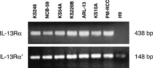 Fig. 2. RT-PCR analysis of IL-13 receptor transcripts. / Total RNA (2.5 μg) of different AIDS-KS cells were reverse transcribed to cDNA and then amplified by PCR using specific IL-13Rα and IL-13Rα′ primers. The PCR products were run on 2% Nusieve 3:1 gel for ultraviolet analysis. pm-RCC and H9 T cells were used as positive and negative controls, respectively.