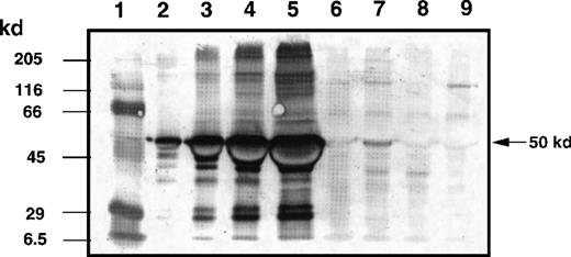 Fig. 7. Determination of IL-13 toxin at tumor bed by Western blot analysis. / The KS Y-1 tumors injected with IL-13 toxin (250 μg/kg, IT) were excised, homogenized, and supernatant collected as described in “Materials and methods.” Aliquots of standard IL-13 toxin (lanes 2, 0.1 μg; lane 3, 0.5 μg; lane 4, 1.0 μg; lane 5, 2.0 μg), supernatants containing 40 μg total protein from control tumor (lane 6), 2 hours (lane 7), 4 hours (lane 8), and 24 hours (lane 9) after injection were run on 10 % SDS-PAGE gel. Molecular weight markers (lane 1) are shown in kilodaltons (kd) on the left. The 50 kd arrow on the right indicates the approximate size of IL-13 toxin.