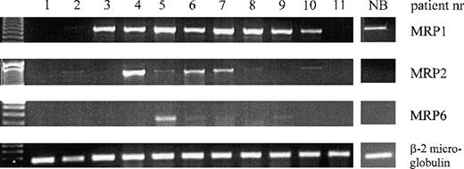 Fig. 3. Expression of MRP1, MRP2, MRP6, and β-2 microglobulin mRNA in AML patient samples and in a representative normal bone marrow control (NB), determined by RT-PCR. / The patient numbers correspond to the numbers in Table 1.