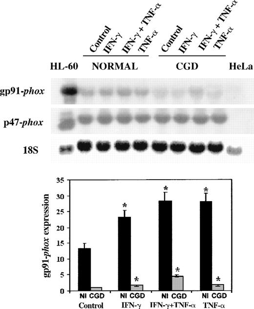Fig. 1. Northern blot of mRNA transcripts encoding gp91-phox and p47-phox. / Each lane contains 10 μg total RNA from IFN-γ–differentiated HL-60 cells, normal, and CGD B-cell lines, or HeLa cells, as indicated above. The autoradiograph shows a representative blot successively probed with32P-labeled cDNAs encoding gp91-phox, p47-phox, and (as a control for equal loading of lanes) 18S rRNA, as indicated in the left margin. The EBV-transformed B-cell lines were cultured in control conditions or in the presence of IFN-γ (100 U/mL), TNF-α (1000 U/mL), alone or in combination for 7 days, as indicated in the top margin.
