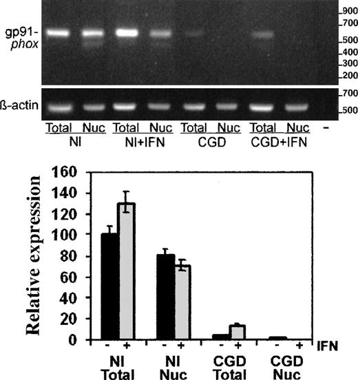Fig. 3. RT-PCR analysis of gp91-phox transcripts in total cell and nuclear RNA preparations. / RT-PCR products of gp91-phox transcripts from the normal (Nl) or CGD patient's EBV-transformed B-cell lines, cultured with or without IFN-γ, as indicated (+IFN). Upper panel: Representative agarose electrophoresis gels, stained with ethidium bromide, of RT-PCR products from the RNA sources indicated below the image. Primers corresponded to cDNAs encoding gp91-phox or β-actin, as indicated in the left margin; size markers are indicated in the right margin. Lower panel: Graph representing compiled data from 3 experiments. Band intensity was quantitated by digital photography and computer analysis with Molecular Analyst software. Data are expressed as percentage expression relative to gp91-phox transcript levels in normal total cellular RNA, adjusted for β-actin signals; columns indicate means and error bars show SDs.