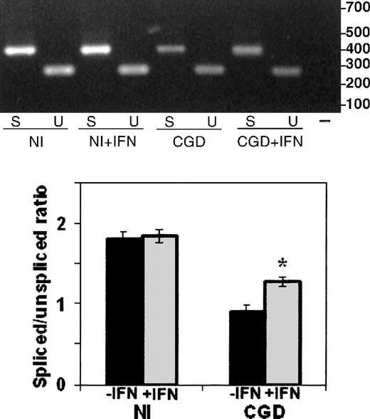 Fig. 5. The effect of IFN-γ on splicing of nuclear CYBBtranscripts in CGD and normal B-cell lines. / RT-PCR products of CYBB nuclear mRNA amplification performed with a forward primer in the first exon and alternative reverse primers in the fifth exon or the first intron (as diagramed in Figure 4) detect, respectively, spliced (S) and unspliced (U) transcripts from nuclei prepared from normal (Nl) or CGD B-cell lines, incubated with (+IFN) or without IFN-γ. Upper panel: Representative ethidium bromide-stained agarose gel of RT-PCR products from the RNA sources indicated below the image; size markers are shown in the right margin. Lower panel: Graph representing compiled data from 3 experiments. Band intensity was quantitated by digital photography and computer analysis with Molecular Analyst software. Data are expressed as the ratio of spliced to unspliced products; columns represent means and error bars show SDs.