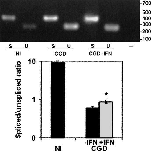 Fig. 6. The effect of IFN-γ on splicing of CYBBtranscripts in total cellular RNA from the CGD patient's peripheral blood monocytes. / RT-PCR products amplified from total RNA extracted from peripheral blood monocytes harvested from the same patient on and off therapy with IFN-γ. Upper panel: Representative ethidium bromide-stained agarose gel of RT-PCR products from the RNA sources indicated below the image; size markers are shown in the right margin. Lower panel: Graph representing compiled data from 3 experiments. Labeling as in Figure5.