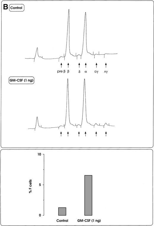 Fig. 2. HbF reactivation in sibling BFU-E colonies. / (A) HbF reactivation in sibling BFU-Es grown in the presence of graded concentrations of GM-CSF or IL-3. HbF synthesis was evaluated in terms of γ-chain content in pooled sibling erythroid colonies. A representative experiment is shown. (B) Globin chain HPLC scans and percentage of F cells from pooled sibling BFU-E colonies grown in unilineage erythroid culture in the presence or absence of GM-CSF (1 ng/mL) (representative results).