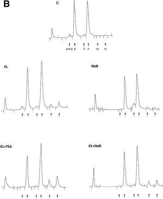 Fig. 5. Minibulk HPC erythroid cultures. / (A) F cells from minibulk HPC erythroid cultures supplemented or not with KL (100 ng/mL) ± TSA (10 ng/mL) ± NaB (0.5 mmol/L). F cells were evaluated by indirect immunofluorescence using an antihuman HbF mAb as a primary antibody and an FITC-conjugated goat antimouse IgG as a secondary antibody. Original magnification × 630. Representative results are shown. (B) Globin chain HPLC scans from mature erythroblasts obtained in minibulk HPC erythroid cultures supplemented or not with KL, TSA, NaB, or combinations thereof (representative results).