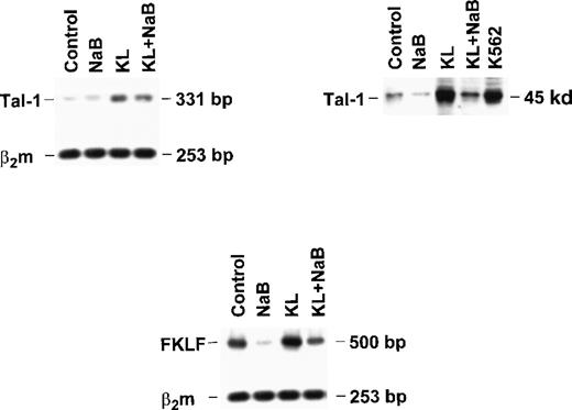Fig. 7. Tal-1 and FKLF expression in bulk HPC erythroid cultures supplemented or not with KL (100 ng/mL) ± NaB (0.5 mmol/L). / Tal-1 expression was evaluated in terms of RT-PCR (right top panel) and Western blotting (left top panel). FKLF expression was analyzed only by RT-PCR (bottom panel).
