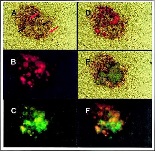 Fig. 2. Transgene expression in erythroid colonies. / ES cells containing the targeted −4.0 kb transgene were differentiated in primary culture for 5 days. Then, embryoid bodies (EB) were disrupted to single cells and plated in a secondary methylcellulose culture. Between 4 and 8 days of secondary culture, colonies of erythroid cells were visible as foci of red cells (globinized areas indicated with red arrows) with nonglobinized cells (black arrows). The erythroid colonies were surrounded by nonerythroid cells of unknown lineage. Original magnification, × 200. (A) Erythroid colonies were observed using either visible, (B) porphyrin-specific, or (C) EGFP-specific wavelengths. (Yellow areas indicate emission filter bleed-through of porphyrin fluorescence combined with green fluorescence) (D) To observe areas of fluorescence in the erythroid colony, the porphyrin fluorescence image was overlaid with the visible image, or (E) the EGFP fluorescence image was overlaid with the visible image. (F) To identify areas of both porphyrin and EGFP expression in the erythroid, the images from porphyrin fluorescence and EGFP fluorescence were overlaid.