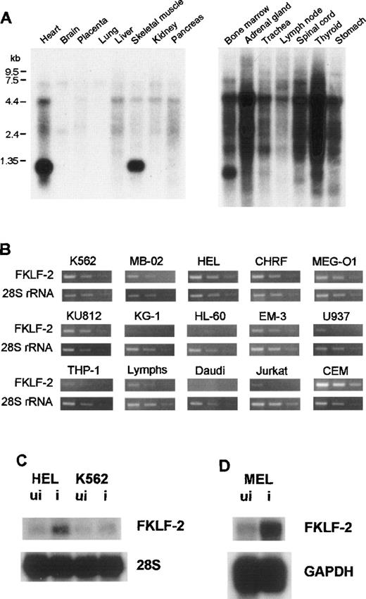 Fig. 2. FKLF-2 mRNA. / (A) FKLF-2 mRNA expression by Northern blotting. Each lane contains 2 μg poly(A)+RNA from adult human tissues. The RNA was blotted with a specific FKLF-2 probe. A distinct band at about 135 kb was detected in the bone marrow and the heart and skeletal muscle. Another major band between 4.4 and 7.5 kb seemed to be a cross hybridization to 28S ribosomal RNA because of its size. (B) FKFL-2 mRNA expression in various cell lines by RT-PCR. Three bands in each picture show the results of amplification in different cycles; ie, from left to right, 34, 32, and 30 cycles for FKLF-2, and 22, 20, and 18 cycles for 28S rRNA. (C) FKLF-2 mRNA expression in K562 and HEL cells before (ui) and after (i) induction by Northern blottings. Two micrograms poly(A)+RNA was blotted with probes indicated. (D) FKLF-2 mRNA expression in MEL cells before and after induction (Northern blotting). Four micrograms poly(A)+RNA was blotted with probes indicated. The position of the FKLF-2 band is approximately 6 kb.