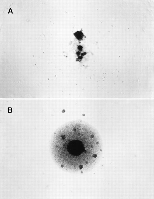 Fig. 1. Identification of hprt−T-lymphocyte clones. / PBMCs were isolated and cloned at 1 to 2 × 104cells/well in the presence of 6-thioguanine (6-TG). Individual wells were scored after 14 to 16 days. (A) A negative clone with no growth in the presence of 6-TG, and only residual feeder cells observed. (B) A positive hprt− mutant clone that grew in the presence of 6-TG, with clusters of growing cells.